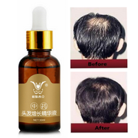 30ml Hair Growth Essence Liquid Chinese Medicine Herbal