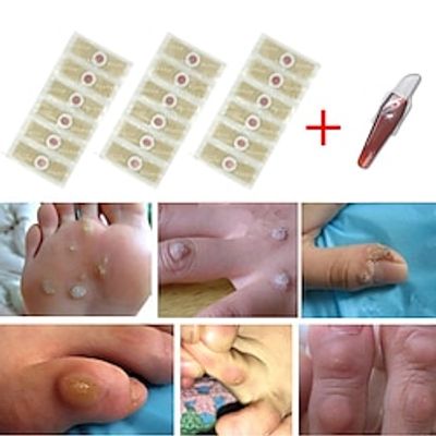 24pcs Medical Foot Care Stickers For Corn Removal, Warts, Thorns, Calluses, Detox  Heal Your Feet miniinthebox