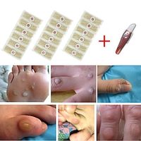 24pcs Medical Foot Care Stickers For Corn Removal, Warts, Thorns, Calluses, Detox  Heal Your Feet miniinthebox - thumbnail