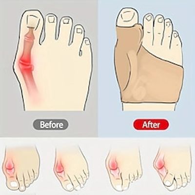 1 Pairs Foot Thumb Valgus Orthopedics Foot Thumb Orthopedics SML Toe Correction Socks Toe Orthopedics Lightinthebox