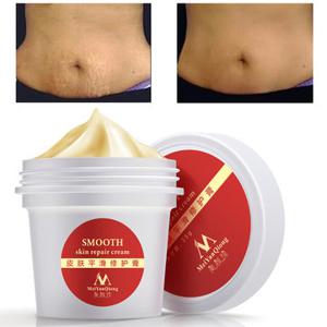 MeiYanQiong Stretch Marks Repairing Cream Scar Removal Maternity Postpartum Smooth Skin Care