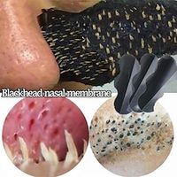 10pcsset Nose Blackhead Remover Mask Pore Cleaner Acne Treatment Mask Deep Nose Pore Cleaning Skin Care Lightinthebox - thumbnail